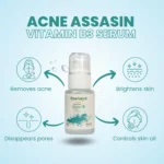 Best Acne Assassin Serum in Pakistan