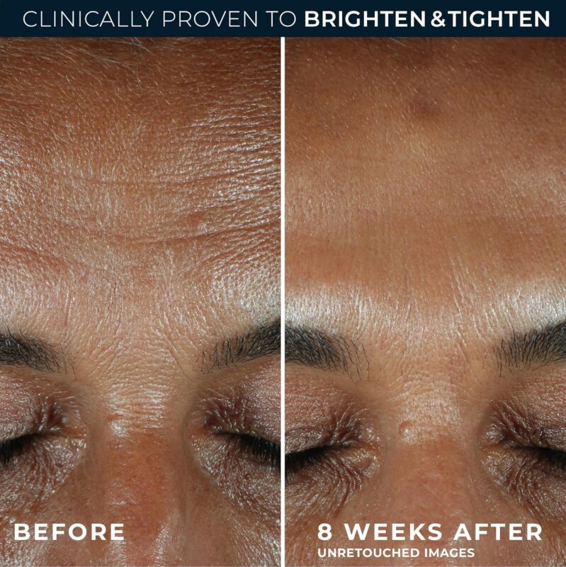 Best Anti-Aging Skin Serum in Pakistan