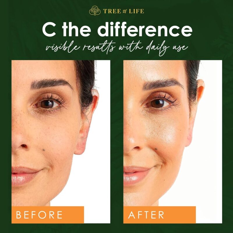 Best Beauty Vitamin Serum in Pakistan