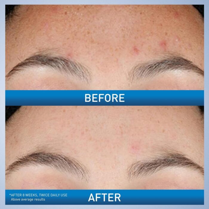 Best CeraVe Resurfacing Serum in Pakistan