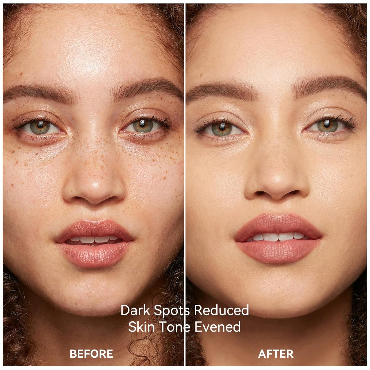 Best Dark Spot Face Serum in Pakistan (3)