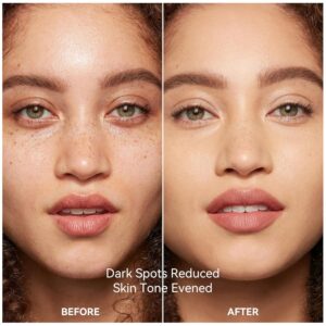 Best Dark Spot Face Serum in Pakistan