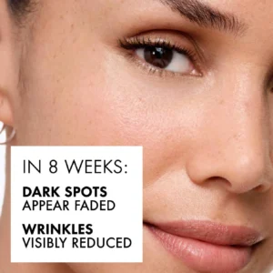 Best Dark Spots Serum in Pakistan