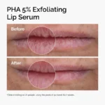 Best Exfoliating Lip Serum in Pakistan