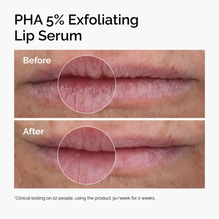Best Exfoliating Lip Serum in Pakistan