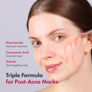 Best Niacinamide Acid Serum in Pakistan