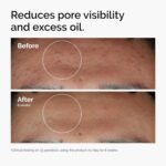 Best Ordinary Niacinamide Serum in Pakistan
