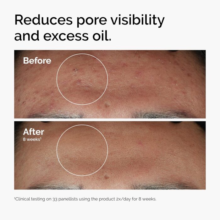 Best Ordinary Niacinamide Serum in Pakistan