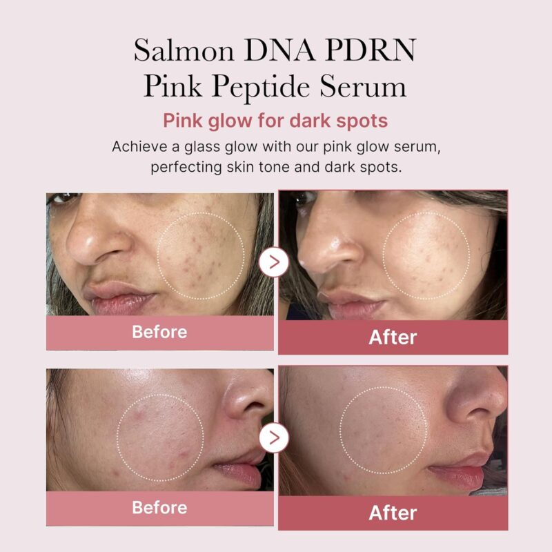 Best Pink Peptide Serum in Pakistan
