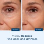 Best Pure Hyaluronic Serum in Pakistan