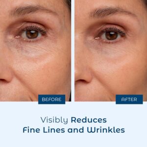 Best Pure Hyaluronic Serum in Pakistan