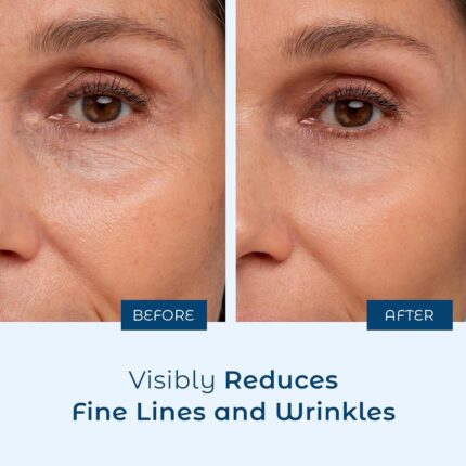 Best Pure Hyaluronic Serum in Pakistan