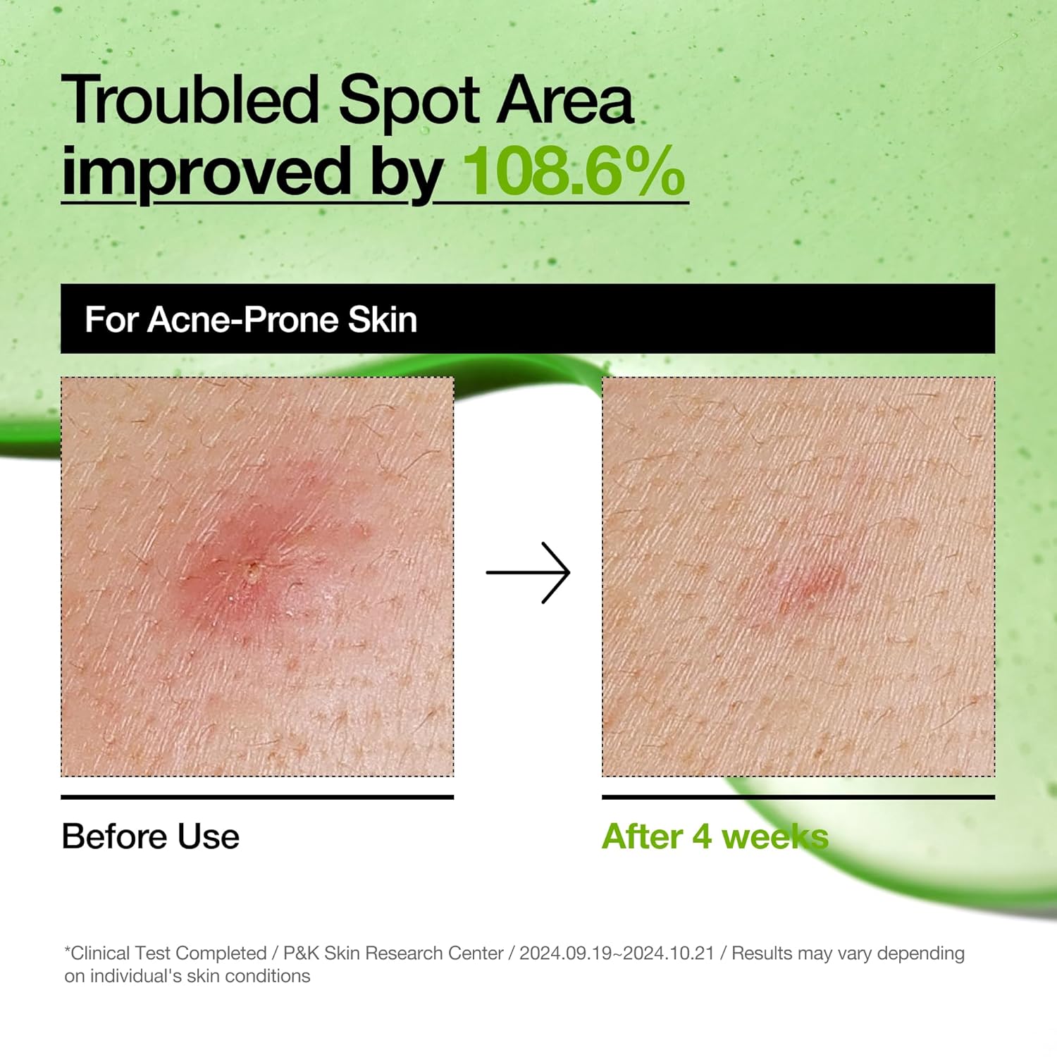 Best Skin Serum in Pakistan
