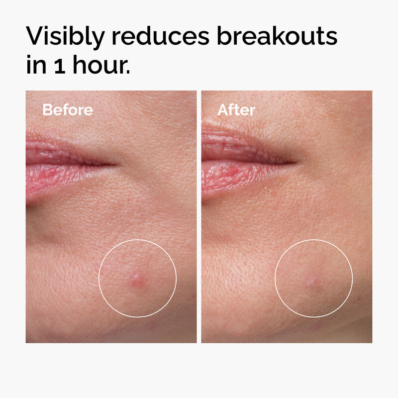 Best Sulfur Powder for Skin in Pakistan