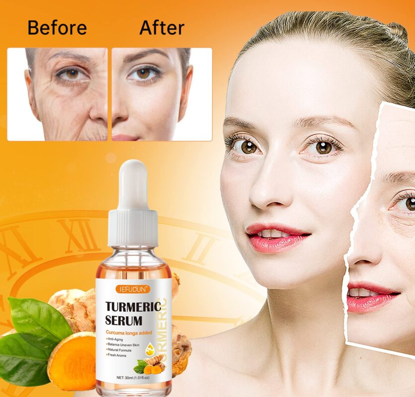 Best Turmeric Dark Spot Serum in Pakistan