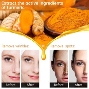 Best Turmeric Dark Spot Serum in Pakistan