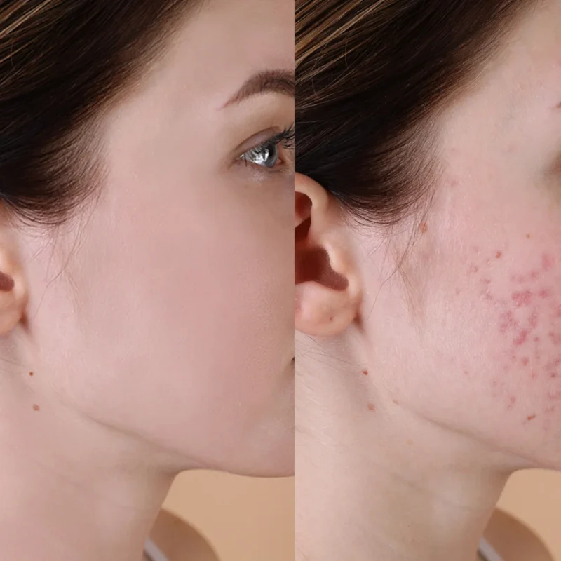 Best Vitamin B5 Serum in Pakistan