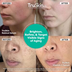 Best Vitamine E Serum in Pakistan