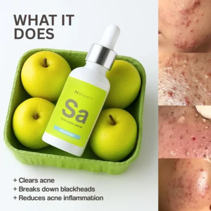 Perfect Salicylic Acid for Acne in Pakistan