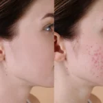 Perfect Vitamin C Serum in Pakistan
