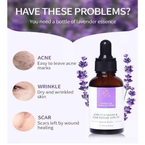 Best Dr Rashel Stretch Mark in Pakistan Best Dr Rashel Stretch Mark in Pakistan