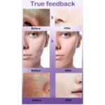 Best lactobionic acid Serum in pakistan