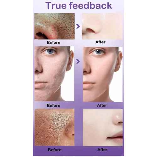 Best lactobionic acid Serum in pakistan Best lactobionic acid Serum in pakistan