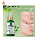 Best Uptown Anti Acne serum in Pakistan