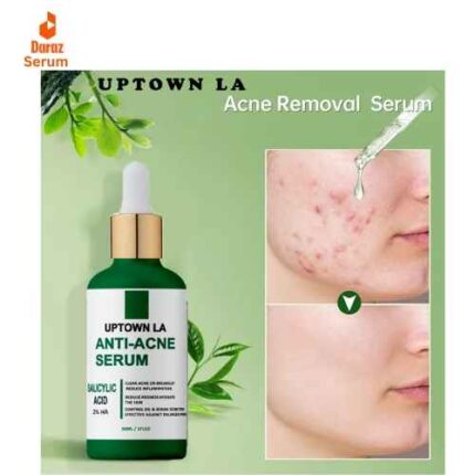 Best Uptown Anti Acne serum in Pakistan