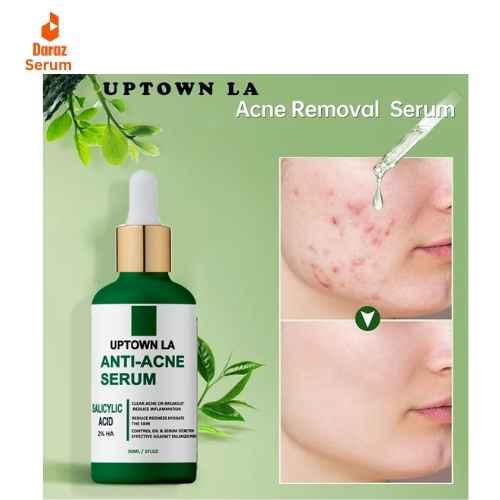 Best Uptown Anti Acne serum in Pakistan Best Uptown Anti Acne serum in Pakistan