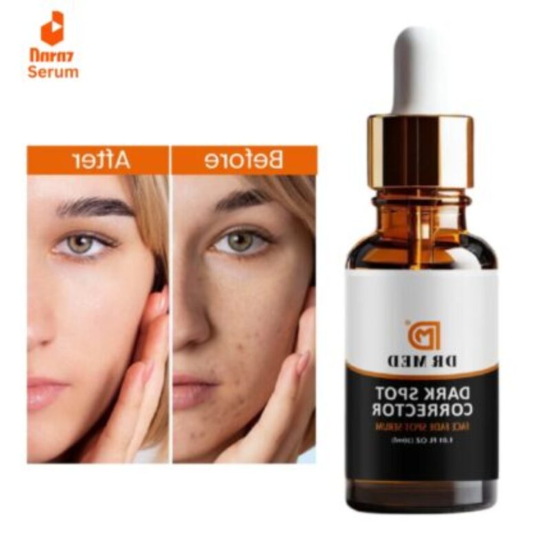 Best Dark Spot Correcter serum in Pakistan