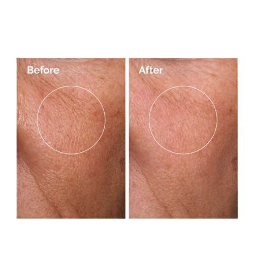 Best Dehydrated Skin Serum in Pakistan