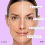 Buy Tranexamic Acid Serum