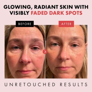 Renewing Retinol Serum for Face