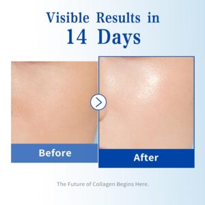 Best 6X Collagen Peptides Serum