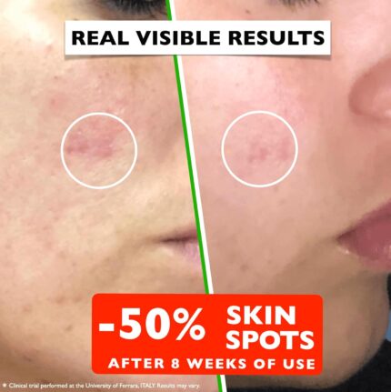 Best Anti Aging Serum with Vitamin C