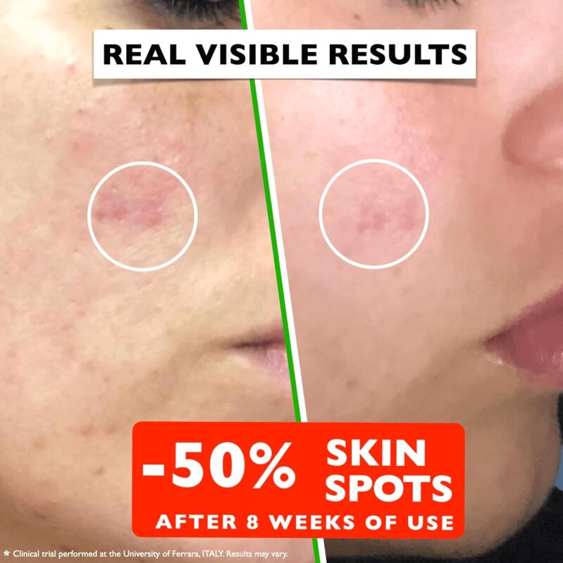 Best Anti Aging Serum with Vitamin C