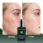 Best Derma Botanica Repair Serum