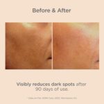 Best Isdinceutics Dark Spot Serum
