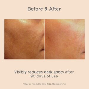 Best Isdinceutics Dark Spot Serum