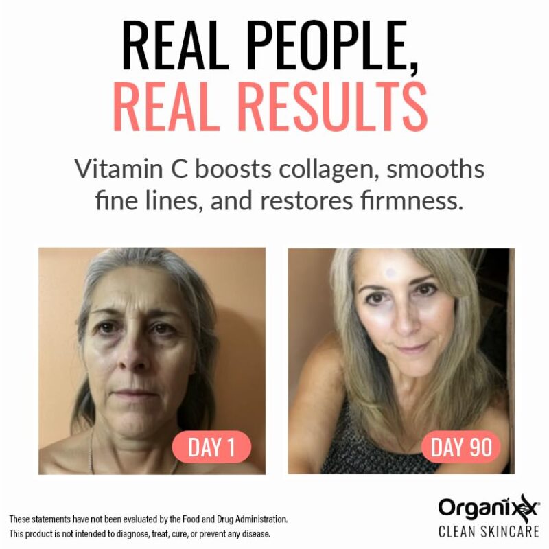 Best Organixx Restore Vitamin C Serum