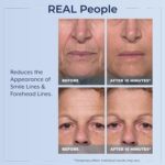 Best Rapid Reduction Eye Serum