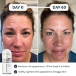 Best Seranova Micro Infusion Serum