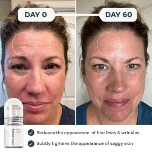 Best Seranova Micro Infusion Serum