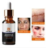 Best Serum for Dark Spot Reduction