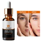 Best Serum for Dark Spot Reduction