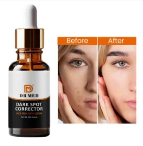 Best Serum for Dark Spot Reduction