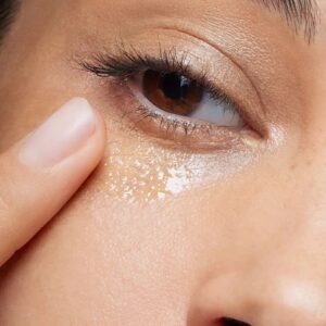 Skinora Serum to Remove Blackheads