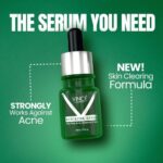 https://darazserum.com/product/best-anti-acne-serum-for-skin/