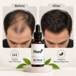 https://darazserum.com/product/buy-max-14-hair-regrowth-serum/